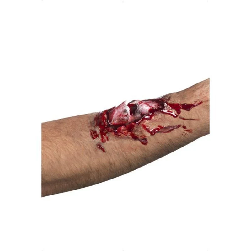 Broken Bone Scar
